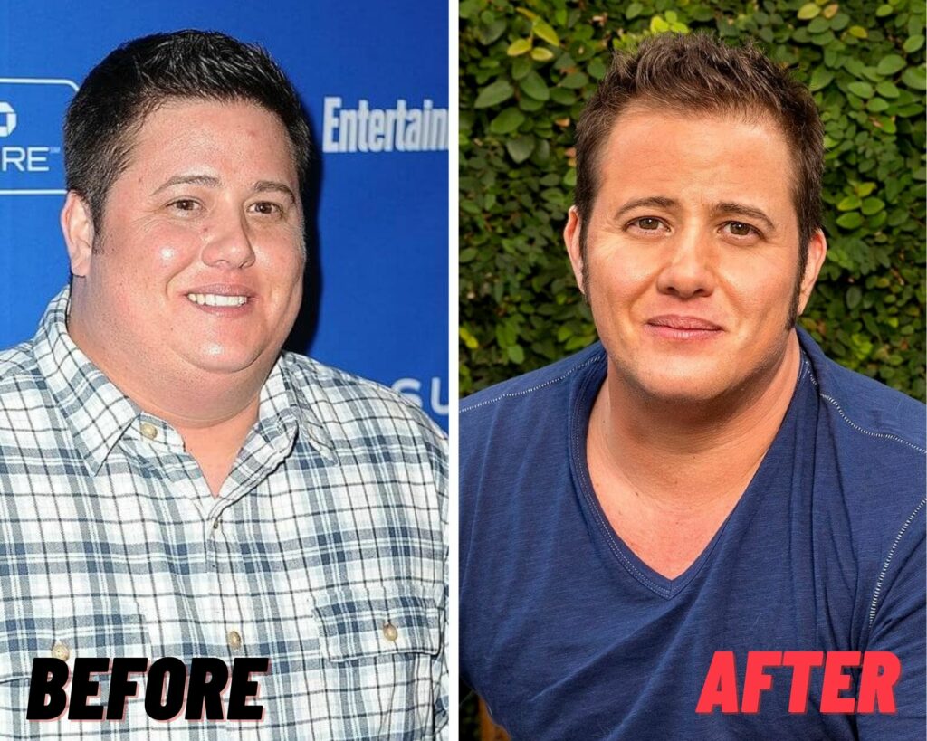 Chaz Bono before after