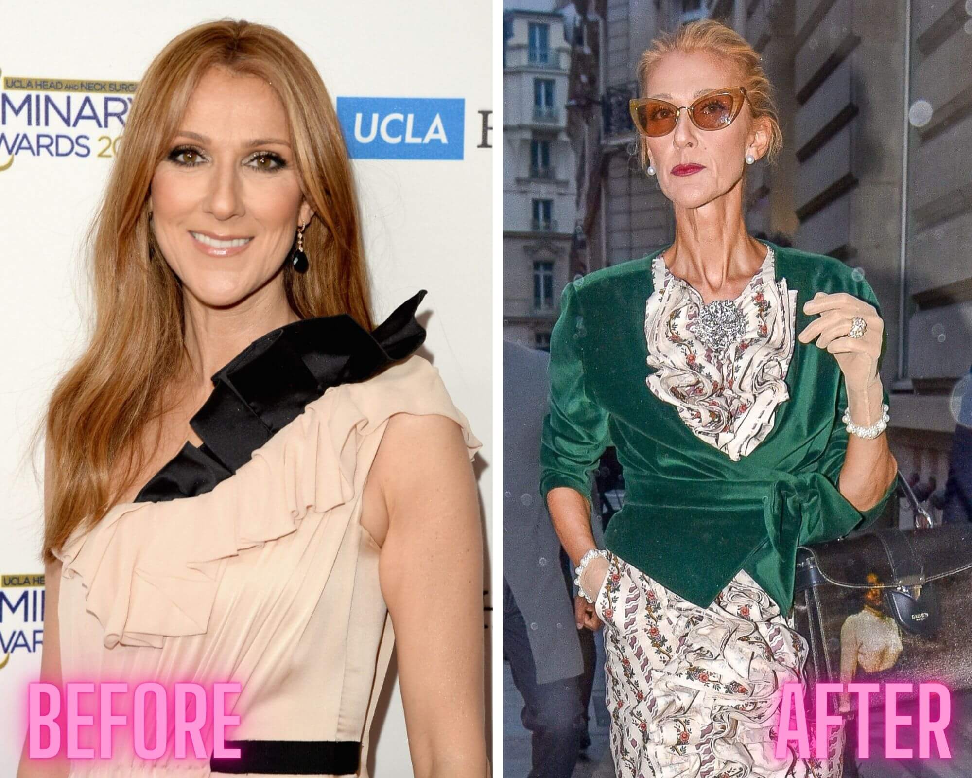 Celine Dion Weight Loss Diet: Secret Revealed By The Singer