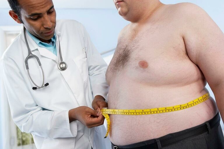 What Are The Risk Factors Of Obesity On COVID 19 Complications?