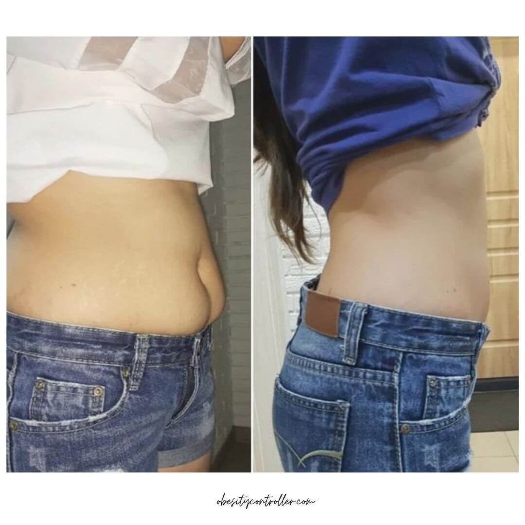 Belly Button Patch results