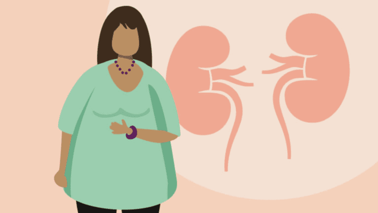 Is Obesity May Affect Kidney Function In Women With Type 2 diabetes?