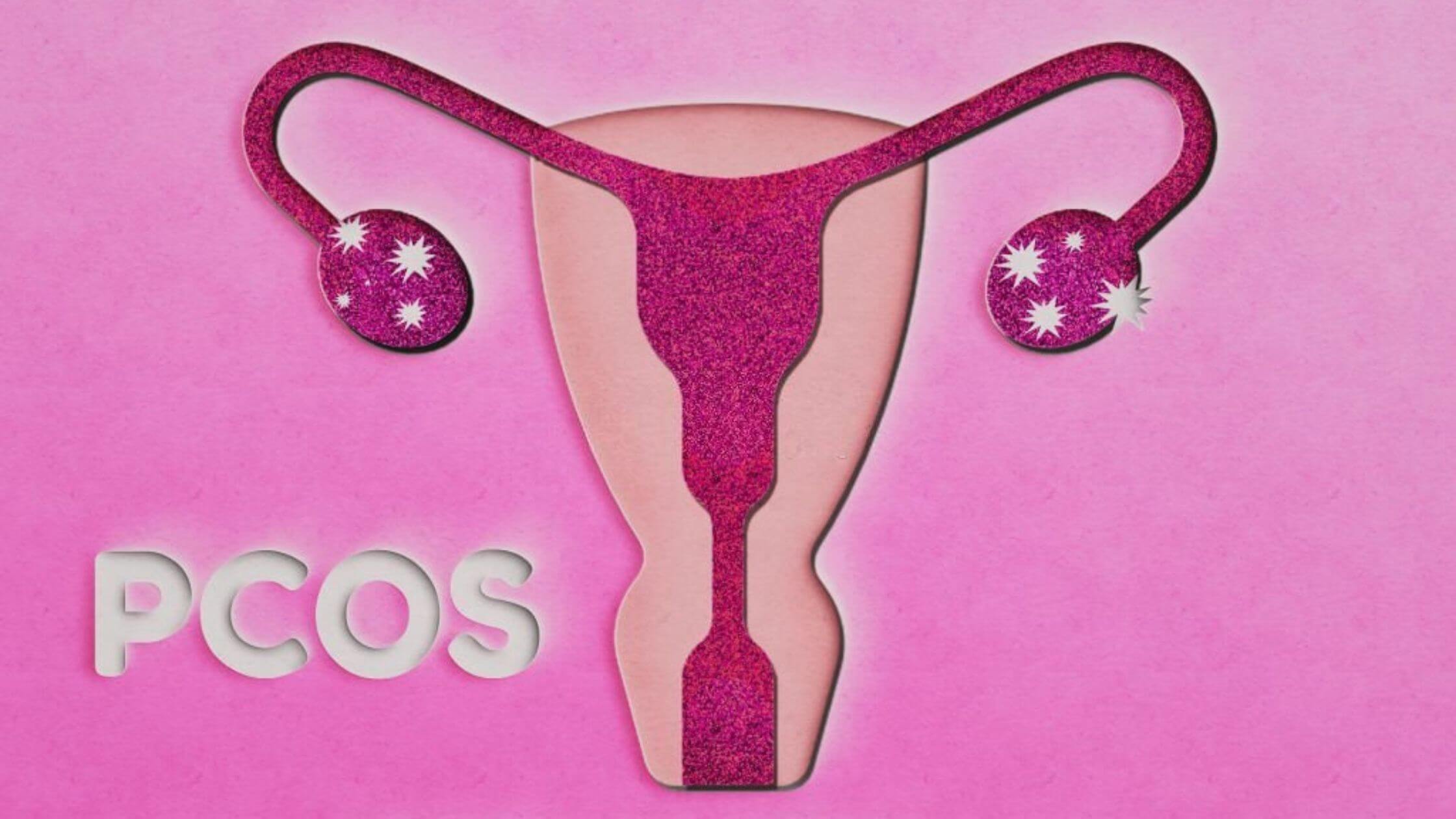 Polycystic Ovary Syndrome PCOS And Weight Gain