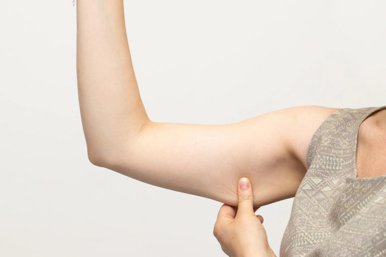 How To Get Rid Of Flabby Arms At Home? Tips That Actually Works