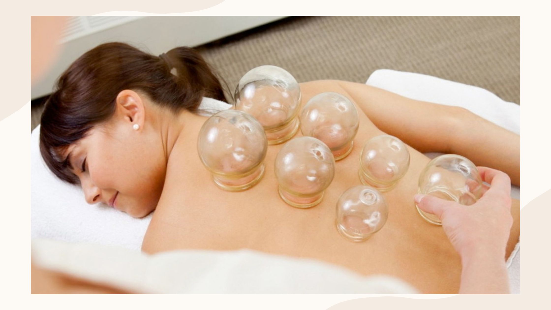 Cupping For Weight Loss