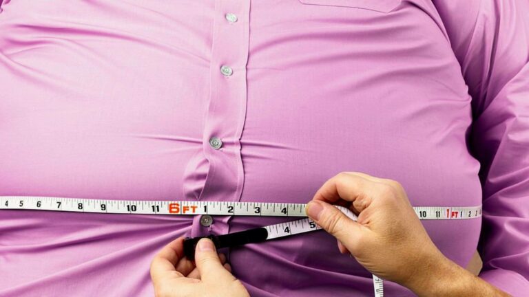 Overweight And Obesity Specialists In Illinois: All You Need To Know!