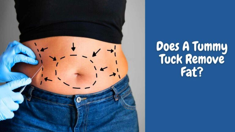 Does A Tummy Tuck Remove Fat? All You Need To Know!