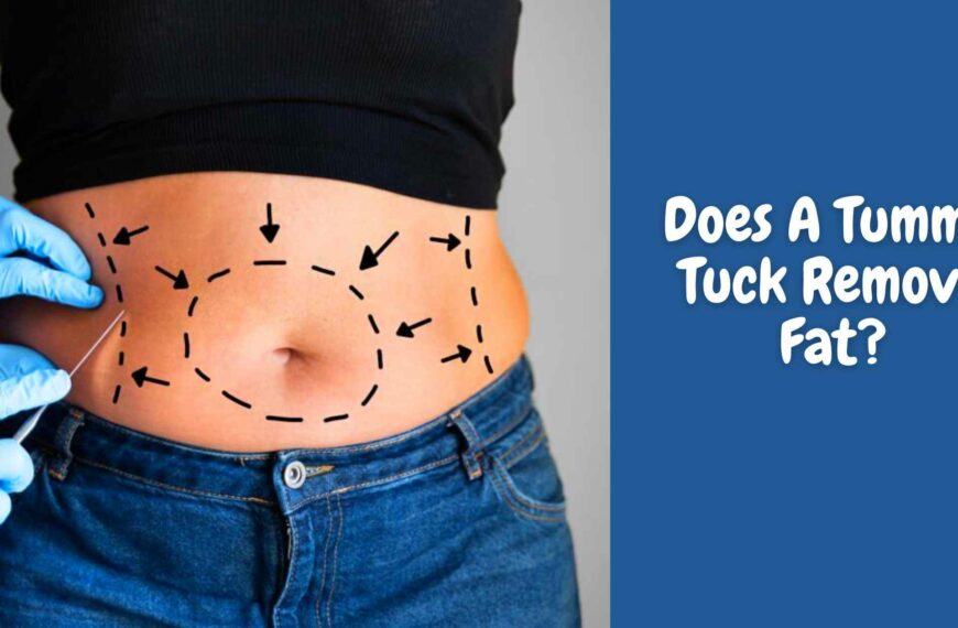 Does A Tummy Tuck Remove Fat