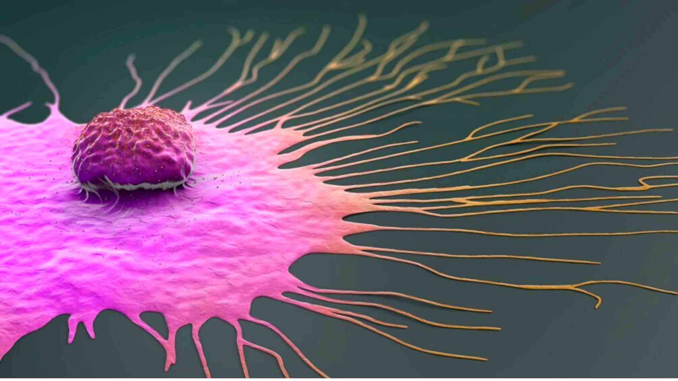 New Drug Shrinks Breast Cancer Tumor