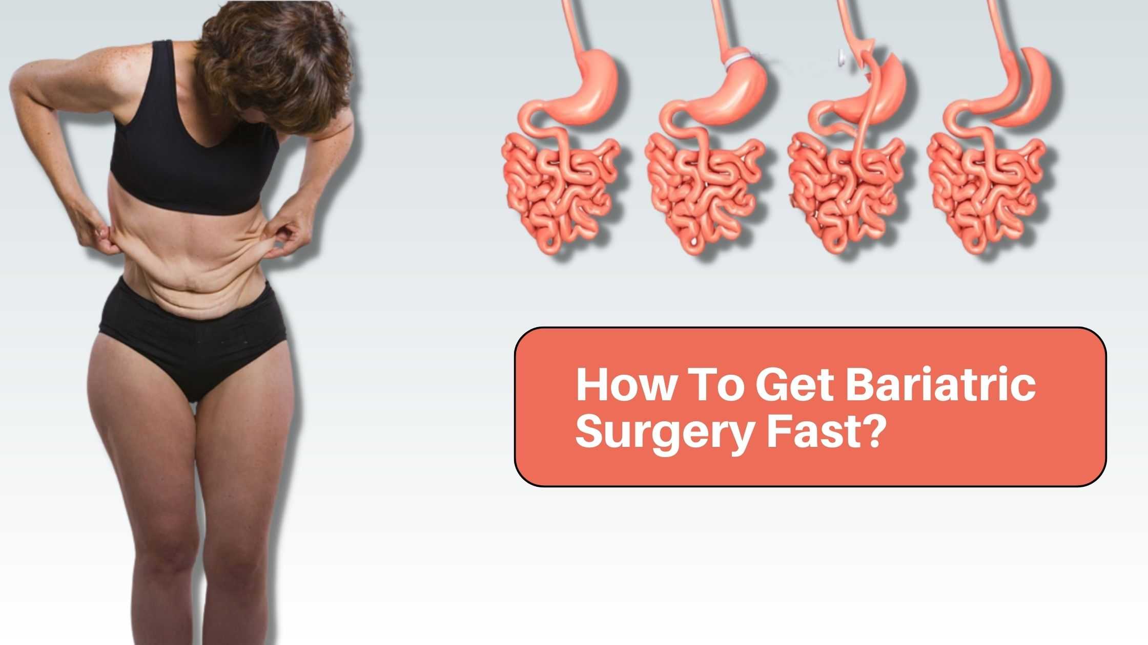 How To Get Bariatric Surgery Fast