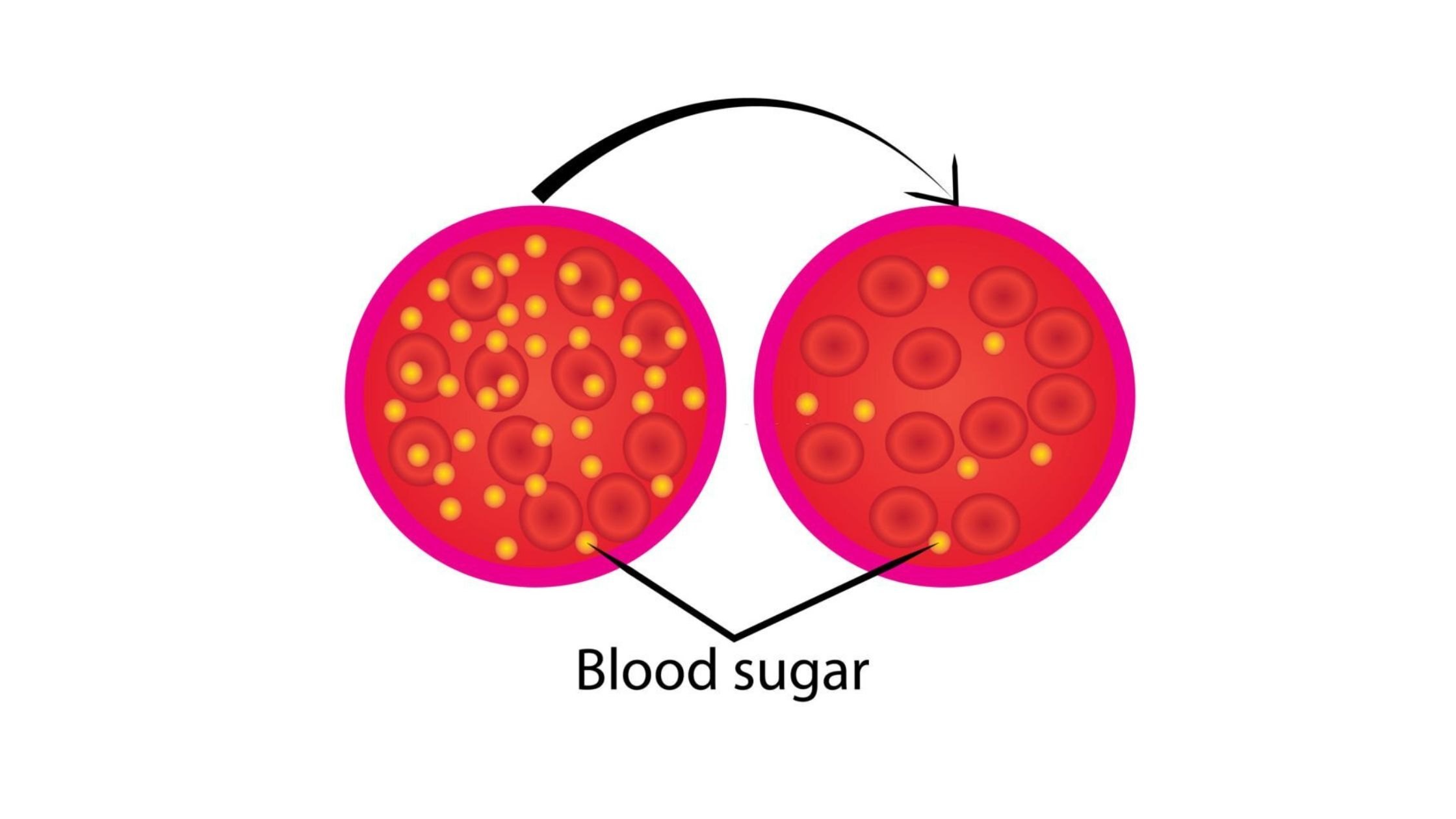 Liquid Thickeners Reduce Blood Sugar After Eating