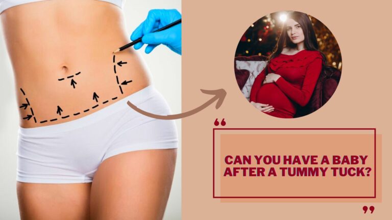 Can You Have A Baby After A Tummy Tuck? Answered!