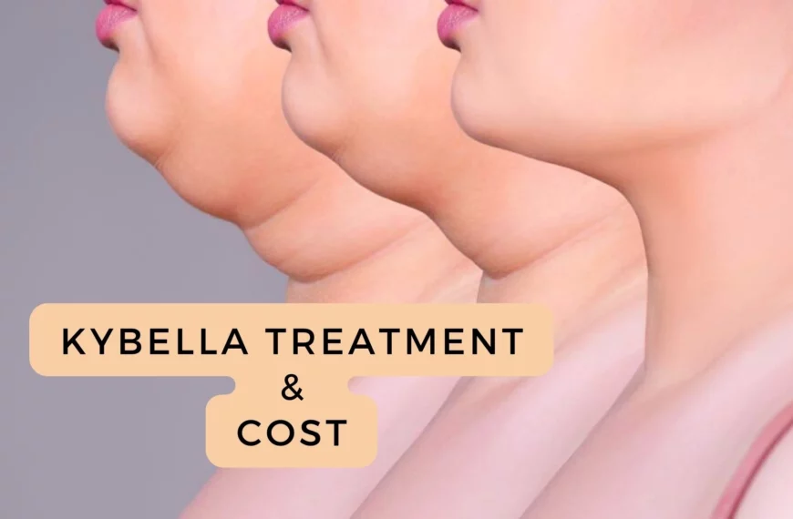 Kybella Cost