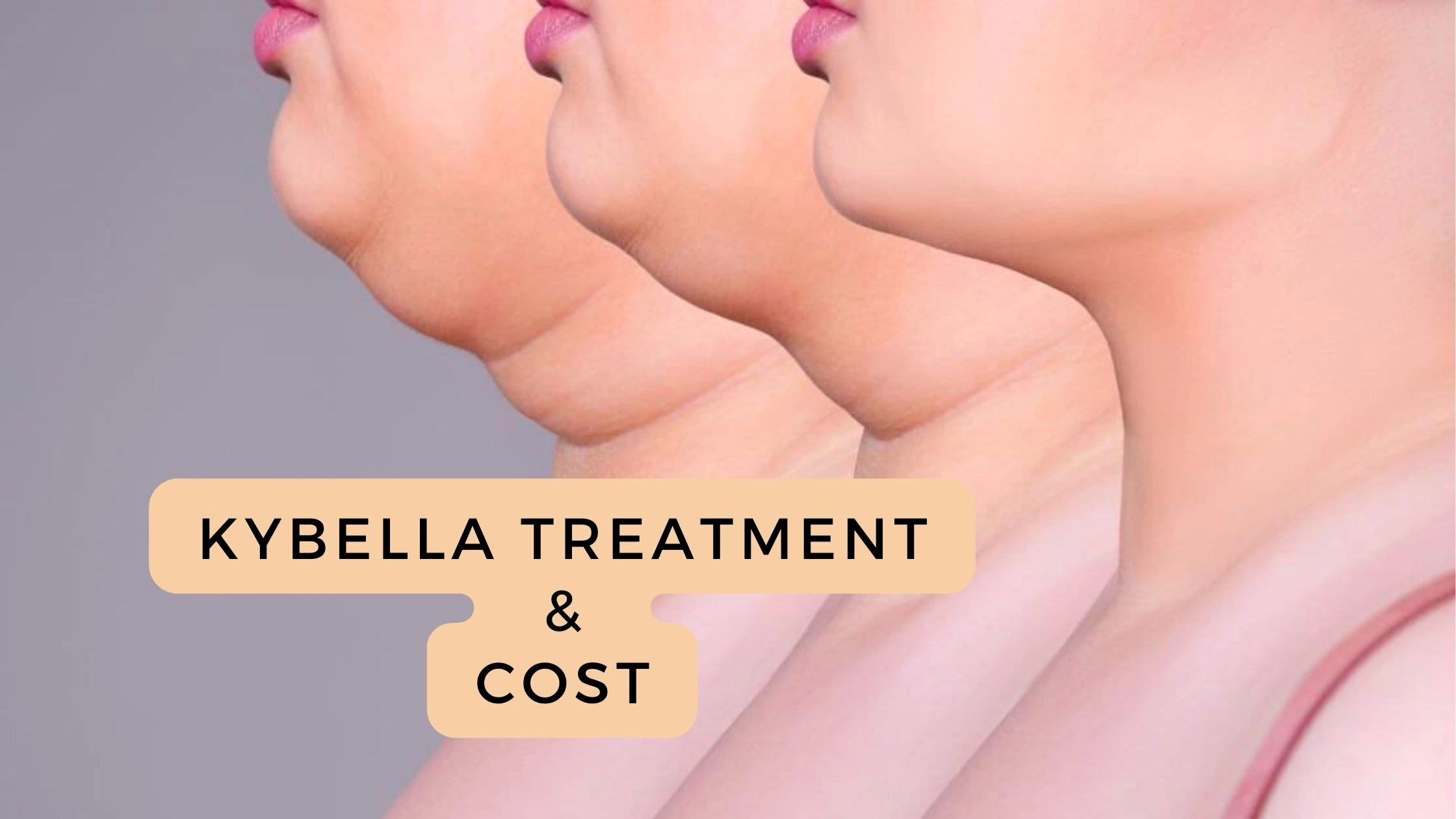 Kybella Cost