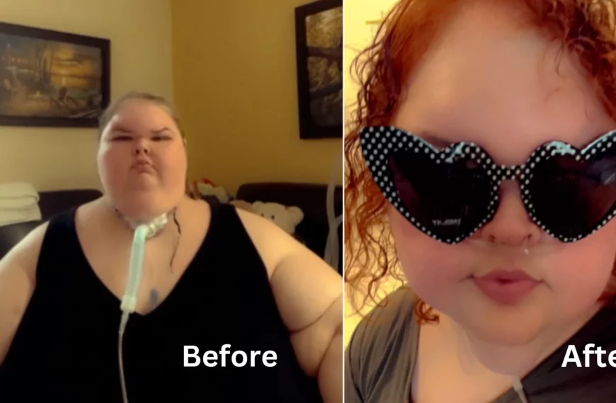 1000-Lb Sisters' Tammy Lost 200-pounds