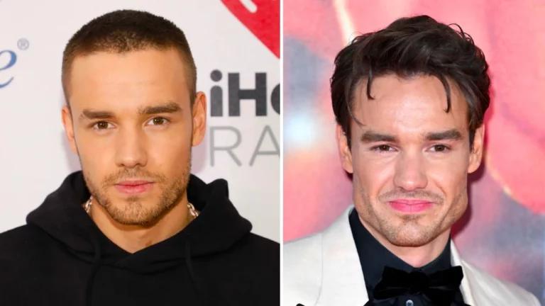 What Happened To Liam Payne’s Face? Fans Speculate About Buccal Fat Removal Surgery