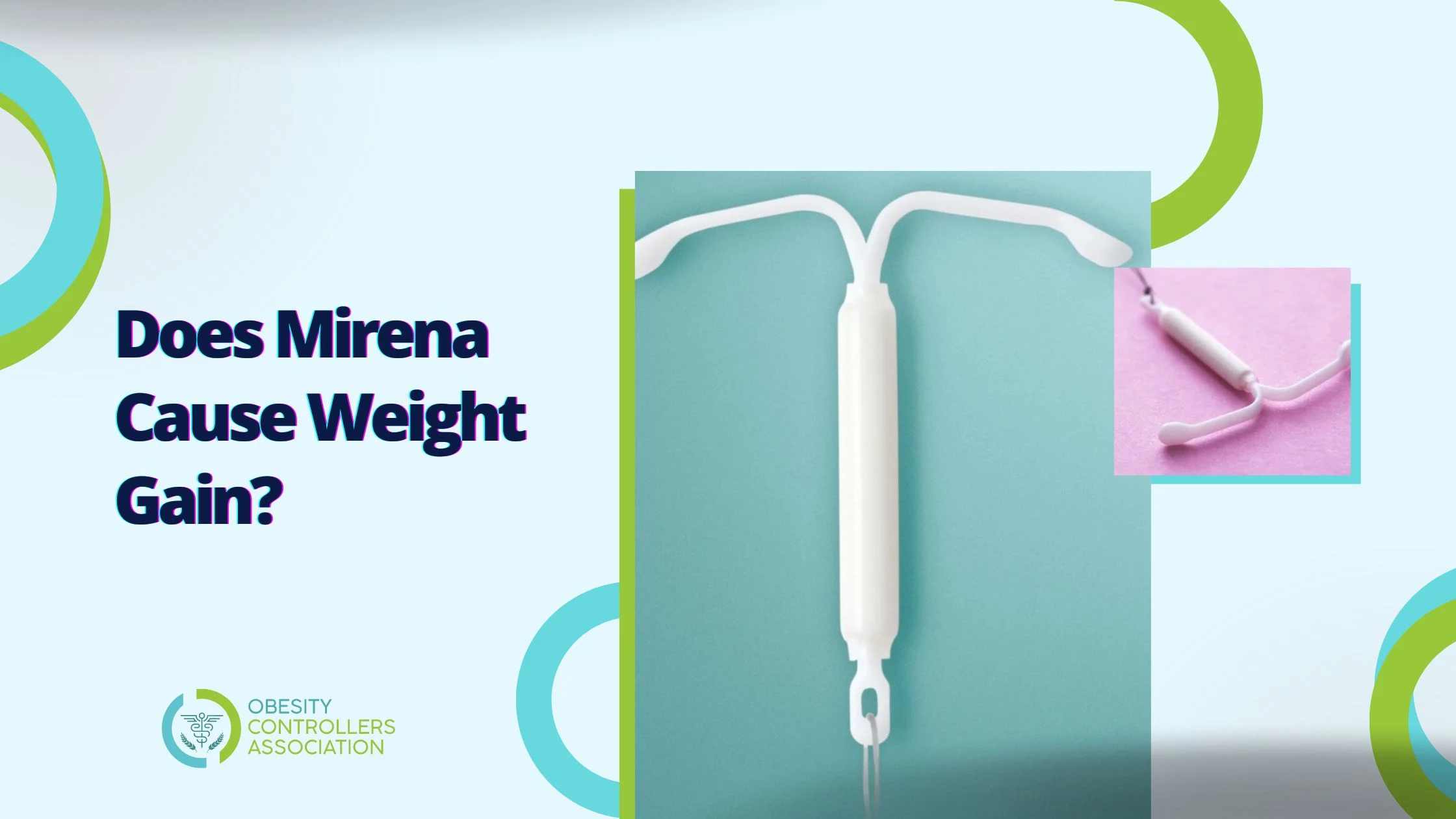 Mirena Weight Gain