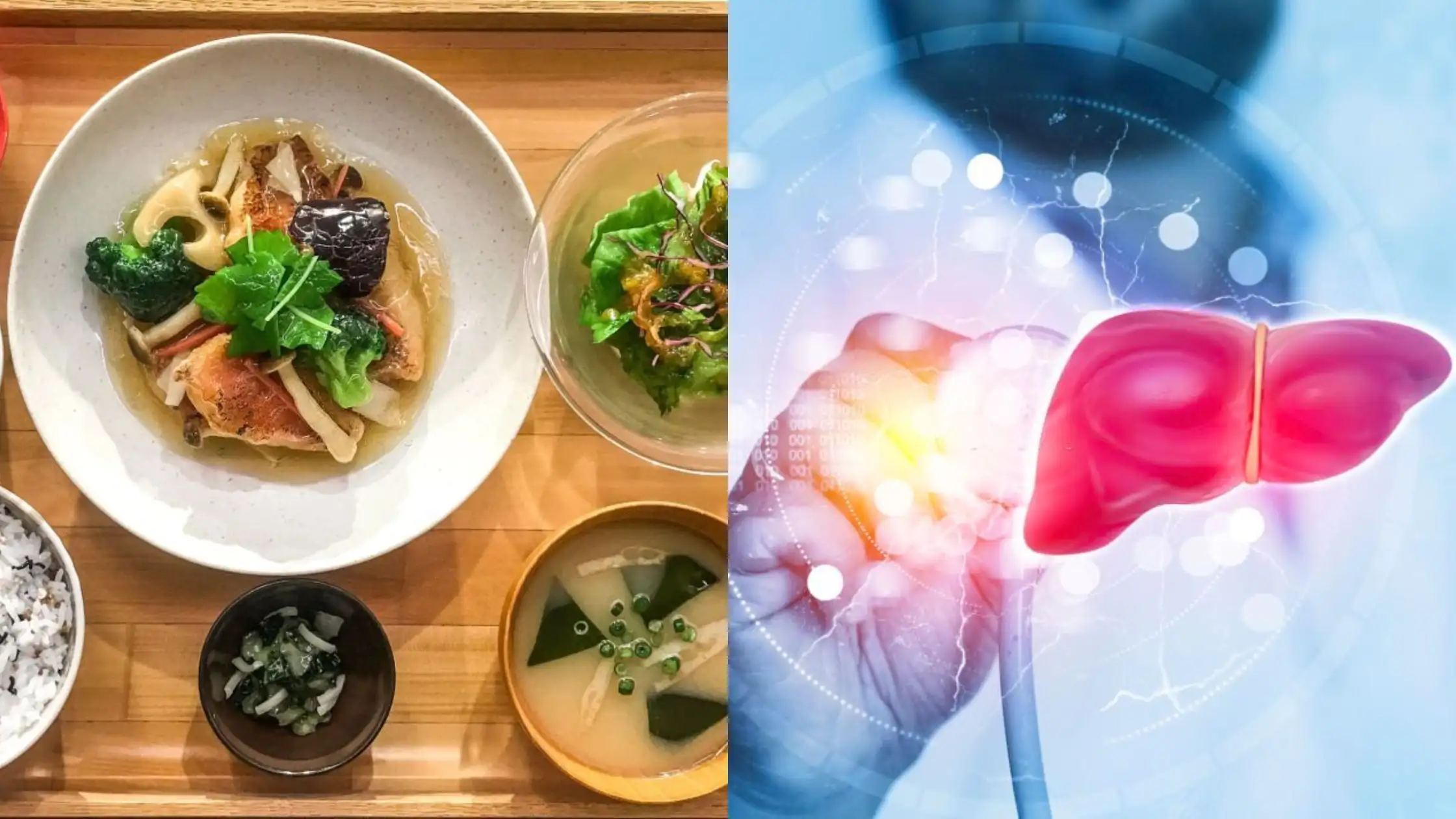 Japanese Diet and Liver Fibrosis