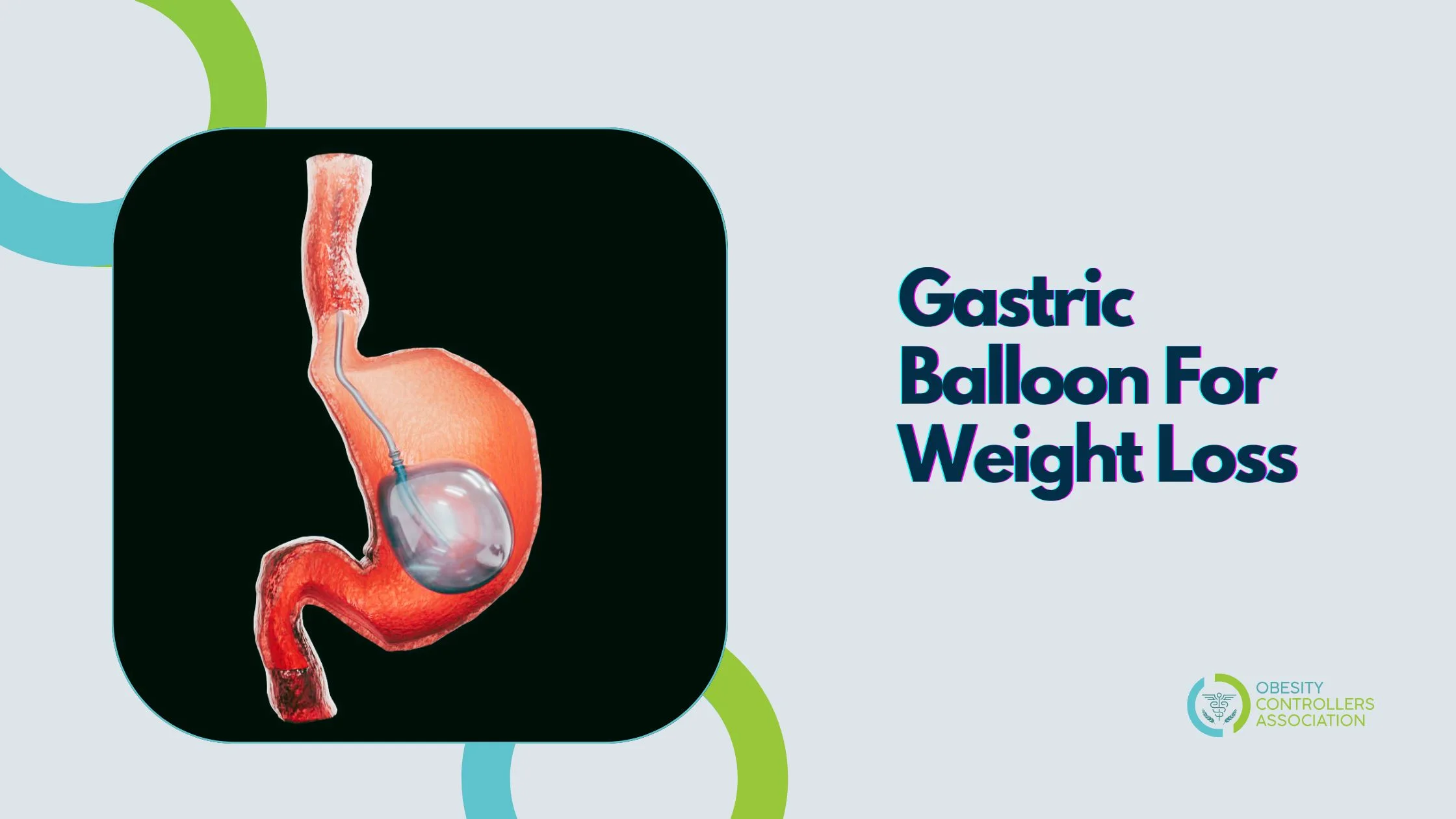 Gastric Balloon Works To Aid Weight Loss
