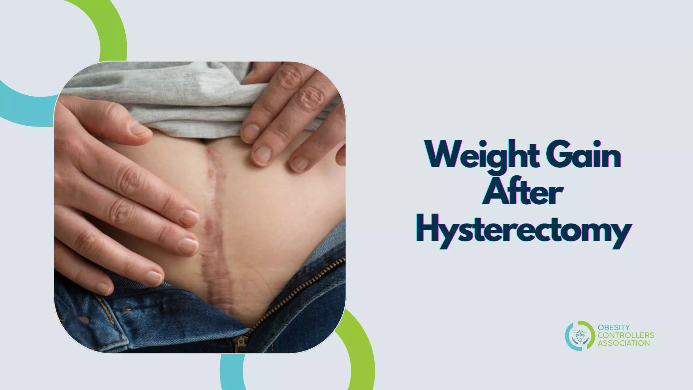 Weight Gain After Hysterectomy