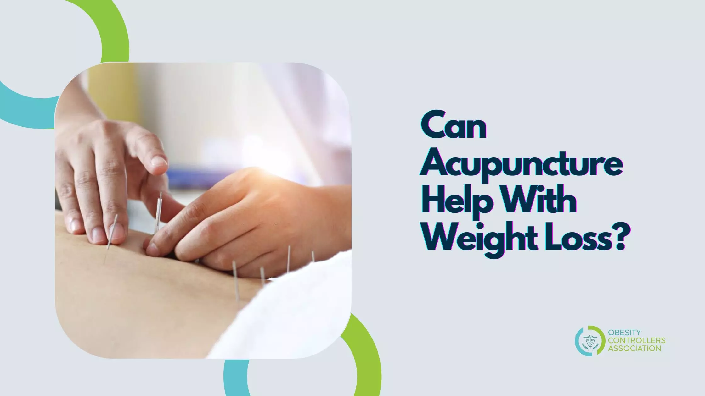 Can Acupuncture Help With Weight Loss