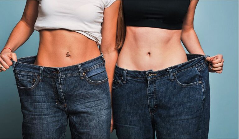 The Incredible Transformations of Obese Liposuction: Dramatic After Impact